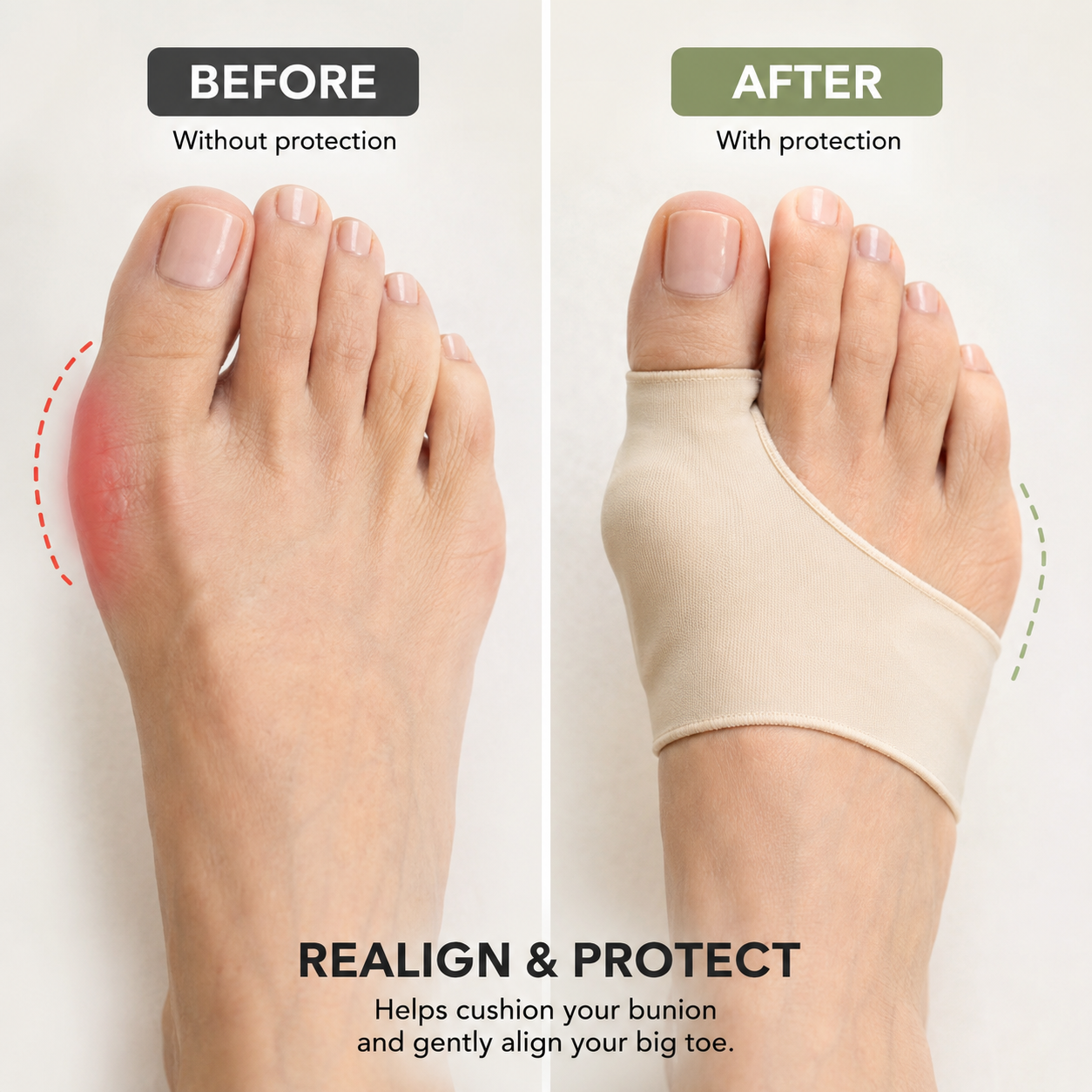 OnHealthWay™ BunionGuard Sleeve