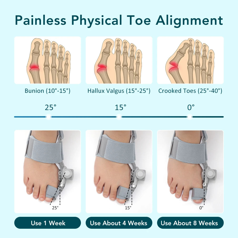 OnHealthWay™ DialAlign Bunion Corrector