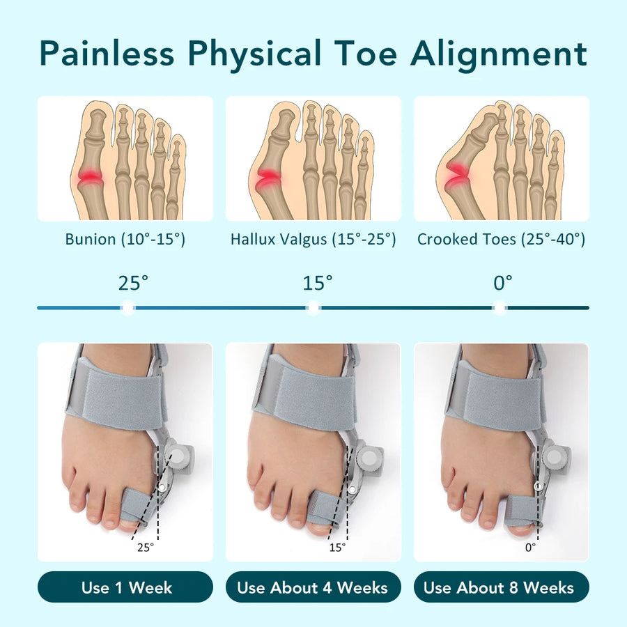 OnHealthWay DialAlign Bunion Corrector