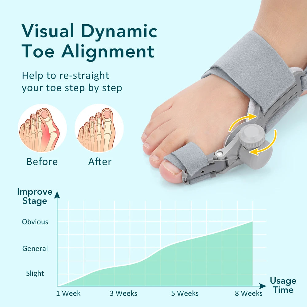 OnHealthWay™ DialAlign Bunion Corrector
